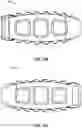 Fig. 50 - Spinal surgery systems and methods