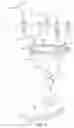 Fig. 02 - Prosthetic external fixation assembly for post-amputee ambulation
