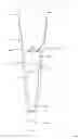 Fig. 02 - Prosthesis cosmetic element, and system consisting of prosthesis cosmetic element and prosthesis