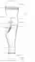 Fig. 05 - Prosthesis cosmetic element, and system consisting of prosthesis cosmetic element and prosthesis