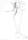 Fig. 11 - Prosthesis cosmetic element, and system consisting of prosthesis cosmetic element and prosthesis