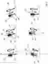 Fig. 05 - Orthopedic joint device