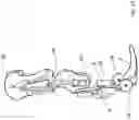 Fig. 14 - Orthopedic joint device