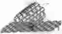 Fig. 01 - Radially rigid and longitudinally flexible multi-element intravascular stent