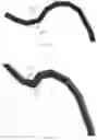 Fig. 09 - Radially rigid and longitudinally flexible multi-element intravascular stent