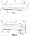 Fig. 05 - METHOD AND APPARATUS FOR STENTING