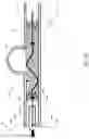 Fig. 09 - Stent delivery with expansion assisting delivery wire