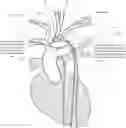 Fig. 01 - Apparatus and method for improved access of procedural catheter in tortuous vessels