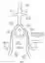 Fig. 20 - Apparatus and method for improved access of procedural catheter in tortuous vessels