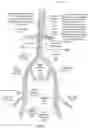 Fig. 24 - Apparatus and method for improved access of procedural catheter in tortuous vessels