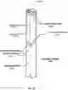 Fig. 27 - Apparatus and method for improved access of procedural catheter in tortuous vessels