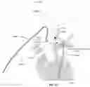 Fig. 29 - Apparatus and method for improved access of procedural catheter in tortuous vessels