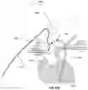 Fig. 30 - Apparatus and method for improved access of procedural catheter in tortuous vessels