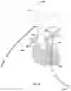 Fig. 32 - Apparatus and method for improved access of procedural catheter in tortuous vessels