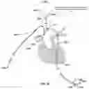 Fig. 35 - Apparatus and method for improved access of procedural catheter in tortuous vessels