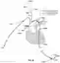 Fig. 37 - Apparatus and method for improved access of procedural catheter in tortuous vessels