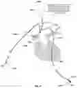 Fig. 40 - Apparatus and method for improved access of procedural catheter in tortuous vessels