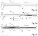Fig. 03 - DEVICE FOR EMBEDDING A BALLOON, ARRANGED ON A CATHETER, IN AN IMPLANT AND ASSOCIATED METHOD