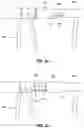 Fig. 05 - Systems, devices, and methods for the accurate deployment and imaging of an implant in the prostatic urethra
