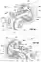 Fig. 20 - Systems, devices, and methods for the accurate deployment and imaging of an implant in the prostatic urethra