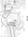 Fig. 26 - Systems, devices, and methods for the accurate deployment and imaging of an implant in the prostatic urethra
