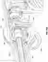 Fig. 28 - Systems, devices, and methods for the accurate deployment and imaging of an implant in the prostatic urethra