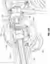 Fig. 29 - Systems, devices, and methods for the accurate deployment and imaging of an implant in the prostatic urethra