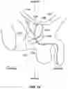 Fig. 35 - Systems, devices, and methods for the accurate deployment and imaging of an implant in the prostatic urethra