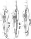 Fig. 07 - Rotary handle stent delivery system and method