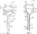 Fig. 02 - TRANSIENT IMPLANTABLE DEVICE TO CONTROL ABSORPTION OF NUTRIENTS