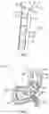 Fig. 03 - TRANSIENT IMPLANTABLE DEVICE TO CONTROL ABSORPTION OF NUTRIENTS