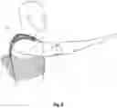 Fig. 09 - ARMLIFTING SUPPORT DEVICE