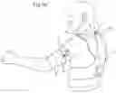Fig. 10 - ARMLIFTING SUPPORT DEVICE