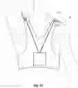 Fig. 14 - ARMLIFTING SUPPORT DEVICE