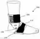 Fig. 01 - MODULAR ANKLE BRACE SYSTEM