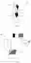 Fig. 03 - MODULAR ANKLE BRACE SYSTEM