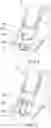 Fig. 05 - CERVICAL COLLAR DEVICE