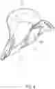 Fig. 07 - CERVICAL COLLAR DEVICE