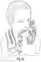 Fig. 20 - Forward head posture correction collar assembly