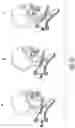 Fig. 22 - Forward head posture correction collar assembly