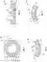 Fig. 02 - Ostomy barrier
