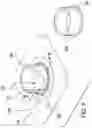 Fig. 02 - COLOSTOMY BAG SPACER ASSEMBLY