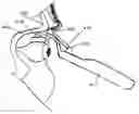 Fig. 01 - IMPLANT DELIVERY DEVICES, SYSTEMS, AND METHODS