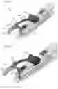 Fig. 03 - IMPLANT DELIVERY DEVICES, SYSTEMS, AND METHODS
