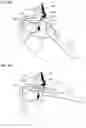 Fig. 10 - IMPLANT DELIVERY DEVICES, SYSTEMS, AND METHODS