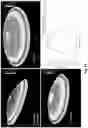 Fig. 15 - NONLINEAR COLLAGEN CROSSLINKING USING A SINGLE, AMPLIFIED, FEMTOSECOND LASER PULSE
