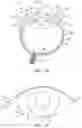 Fig. 02 - OCULAR INSERT APPARATUS AND METHODS
