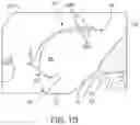 Fig. 04 - OCULAR INSERT APPARATUS AND METHODS