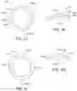 Fig. 19 - OCULAR INSERT APPARATUS AND METHODS