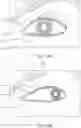 Fig. 63 - OCULAR INSERT APPARATUS AND METHODS